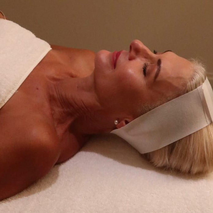 Skin Needling (New Client Offer) $189 image 1