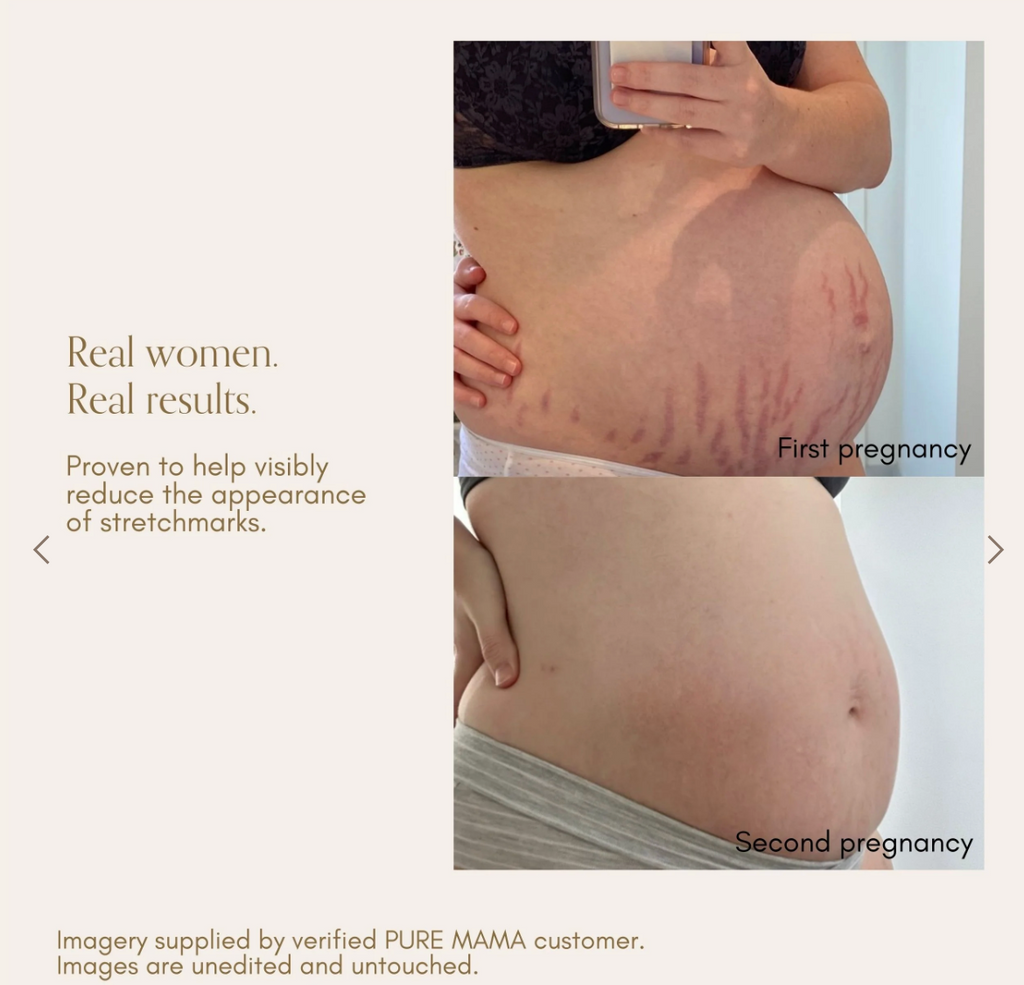 Belly Oil image 1