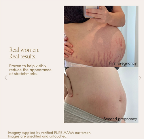 Belly Oil image 1